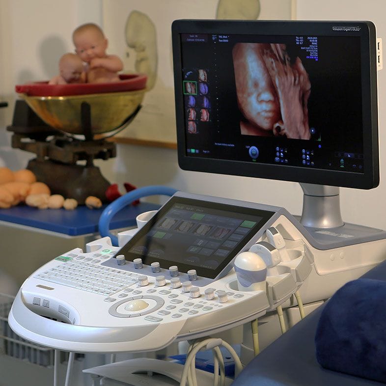 An ultrasound scanning machine with its screen and probe in a clinic room